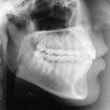 Radiologia Odontológica no Cabo de Santo Agostinho